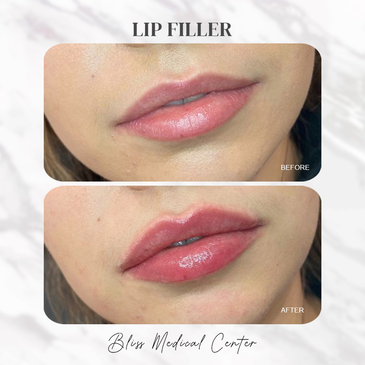 Slider image (3) Bliss Medical Centre Ajman, Jurf